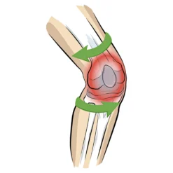 Kniebandage "Patella Tec"