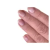 Warzen-Ex Tinktur, 2 ml